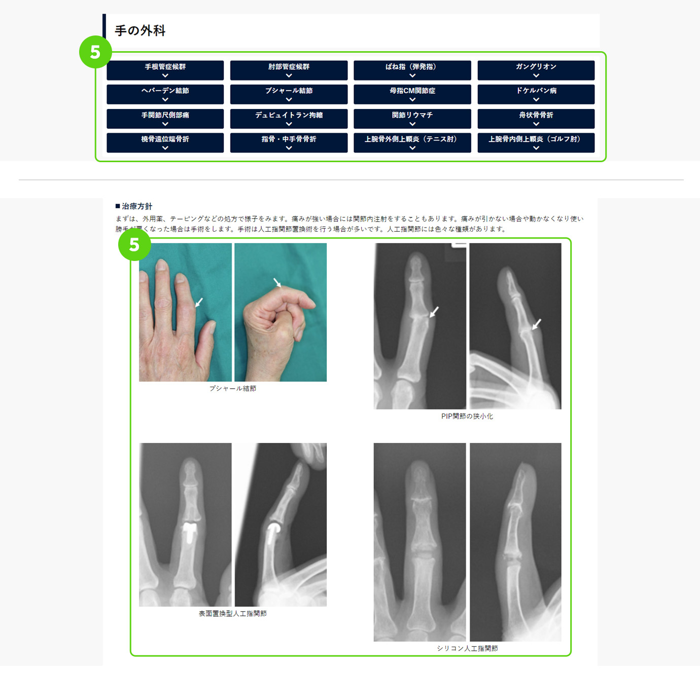 画像：TMGあさか医療センター 整形外科③